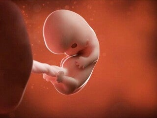 8 semanas de embarazo 8 semanas de embarazo