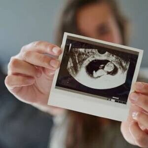 Desarrollo fetal Mujer sosteniendo una imagen por ecografía