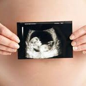 ecografia obstetrica ecografia obstetrica