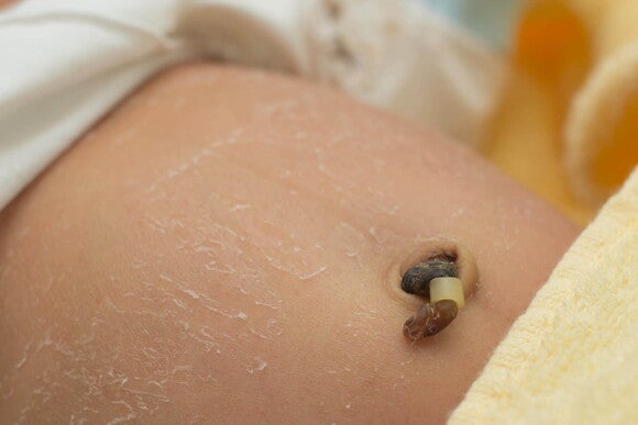 Higiene adecuada para tu bebé pancita de bebé con cordón umbilical
