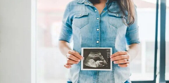 Conoce todos los cuidados en este nuevo embarazo. Mamá mostrando la ecografía de su bebé arcoíris en camino.